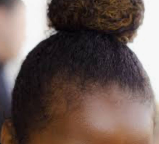 Thinning Edges