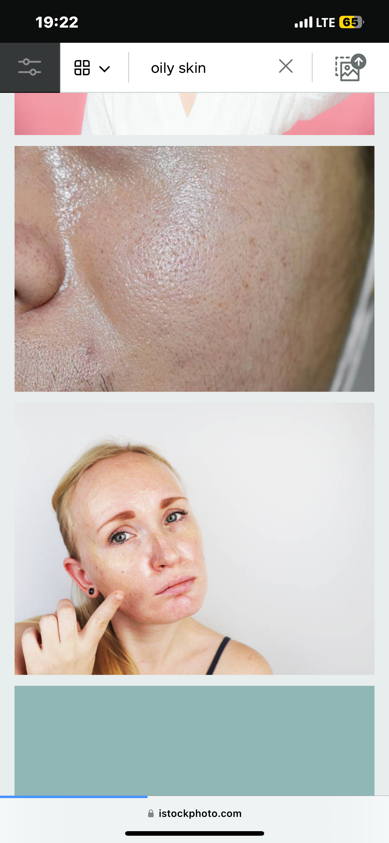Oily Skin